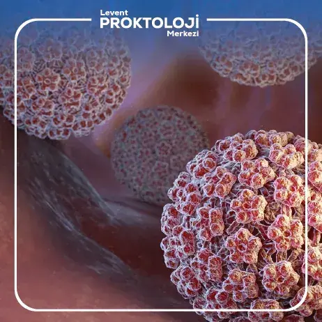 Genital Siğil (Kondilom) Tedavisi